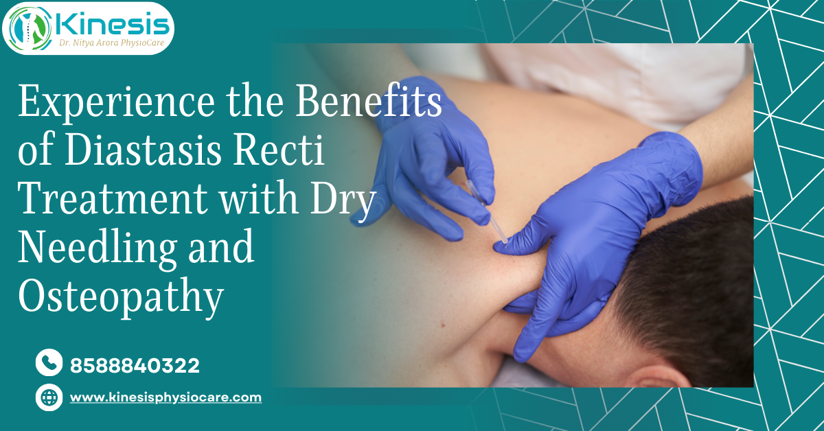 Benefits of Diastasis Recti Treatment with Dry Needling and Osteopathy